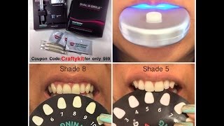 Whitening Lightning How to Whiten Your Teeth in 20 Minutes [upl. by Ardnod]