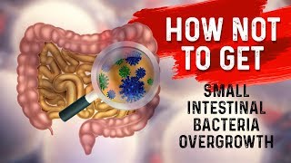 How to STOP Small Intestine Bacterial OvergrowthSIBO – Dr Berg [upl. by Sisi277]