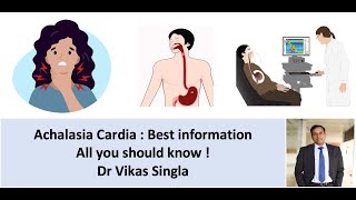 Achalasia cardia  Symptoms causes diagnosis treatment in Hindi Dr Vikas Sing [upl. by Rochkind]