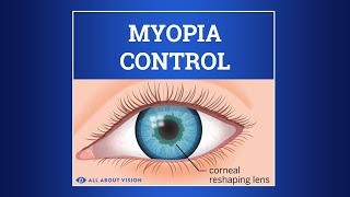 Myopia Control [upl. by Akym]