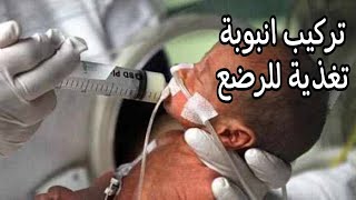 تركيب انبوبة معدة للرضع  تركيب انبوبة التغذية للاطفال insert orogastric tube for neonate [upl. by Salbu]