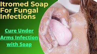 Best Soap For Fungal Infection Itraconazole Soap For Fungal Antifungal soaps for Under Arms [upl. by Ritter101]