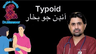 Typhoid  Sindhu health  DrMansoor  in Sindhi  awareness [upl. by Mcilroy703]