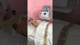 Cavitation RF Vacuum Body Lipo Laser Microcurrent Treatment [upl. by Aratahc]