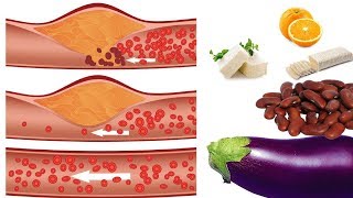 9 Makanan Penurun Kolesterol LDL Tinggi dengan Cepat [upl. by Yelekalb]