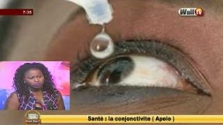 SANTE la conjonctivite Apolo dans Petit Dej du 07 nov 2016 avec Amina [upl. by Aubyn]