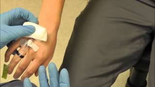 How to Remove an IV [upl. by Adao]