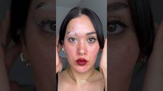 Sharing one of my fav videos as a reminder that no skin is bad 🤍 vitiligo acne poliosis skin [upl. by Ehtiaf542]