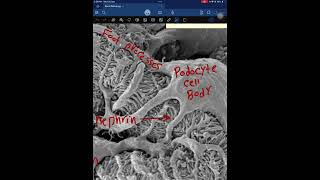 Kidney pathology part 1 [upl. by Ayik869]