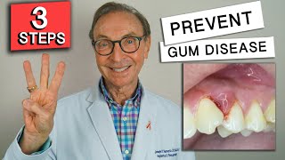 3 Easy Ways to Prevent Gum Disease at Home [upl. by Ceciley]