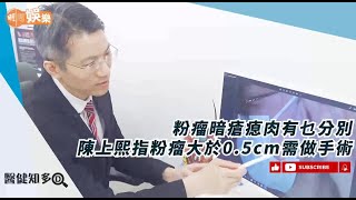 粉瘤暗瘡瘜肉有乜分別 陳上熙指粉瘤大於05cm 需做手術醫健知多D [upl. by Gemoets]