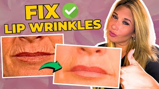 Say Goodbye to Lip Lines Top Treatments and Prevention Tips Revealed [upl. by Nacnud]