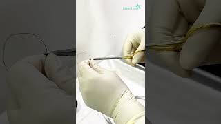 Biopsy for histopathology  Dhaka Dermatology Institute  LaserTreat [upl. by Anbul]