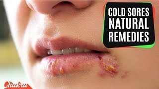 10 Most Effective Natural Home Remedies for Cold Sores [upl. by Melan]