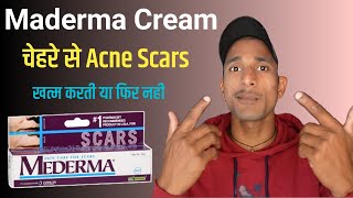 Maderma Advance Scar Gel Review  How To Use Maderma Cream  Maderma For Acne Scars [upl. by Virgy]