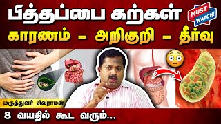 பித்தப்பை கல் உங்களுக்கு இந்த அறிகுறிகள் இருக்கா Dr Sivaraman speech about Gallstones in Tamil [upl. by Keldah]