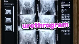 How i prepare urethrogram x ray  x ray urethrogram taking and filming [upl. by Elad]