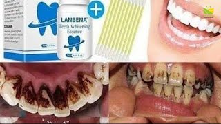 LANBENA TEETH WHITENING ESSENCE POWDER ORAL HYGIENE CLEANING SERUM [upl. by Huggins]