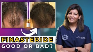 Hair loss मैं FINASTERIDE कितना जरूरी है  Right Age to Start Finasteride  Dr Nandini Dadu [upl. by Deppy425]