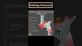 Diseases with Bronchovascular Spread  Shorts  Mnemonic 2 [upl. by Scarrow245]