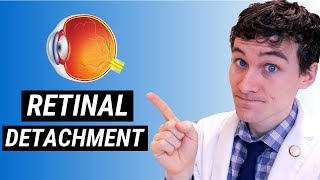 Retinal Detachment Symptoms and Treatment  How Retinal Detachment is Treated [upl. by Allsopp151]