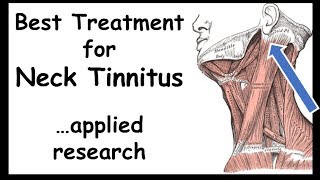 Best Treatment for NeckTinnitus  Somatictype [upl. by Quiteris43]