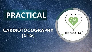 Cardiotocography  CTG   part 2 [upl. by Kerwon]