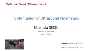 3 ULTRASOUND  OPTIMIZATION OF PARAMETERS radiology ultrasound [upl. by Anzovin]