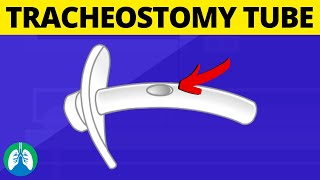 Tracheostomy Tube Medical Definition  Quick Explainer Video [upl. by Jenkel]