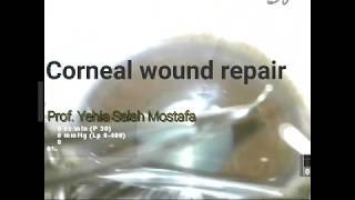 Corneal wound repair [upl. by Myriam814]