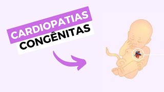 Cardiopatias congênitas CIANÓTICAS e ACIANÓTICAS  cardiopediatria [upl. by Ahsinyd967]