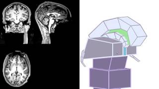 MRI  3D Brain Anatomy Hypothalamus Pituitary Gland Fornix Corpus Callosum amp 3rd Ventricle [upl. by Anirbed]