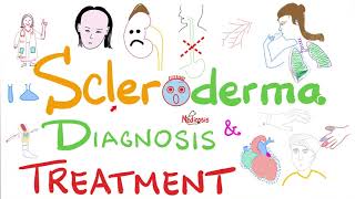 Scleroderma Diagnosis and Management [upl. by Trillby538]