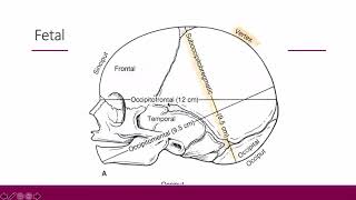 Malpresentation and malposition  obstetrics [upl. by Nodarse]