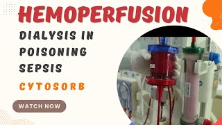 What is Hemoperfusion  Dialysis in Poisoning  Dialysis in sepsis  cytosorb [upl. by Ardnael876]