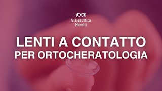 LENTI A CONTATTO PER ORTOCHERATOLOGIA  scopri come funzionano [upl. by Blanchard]