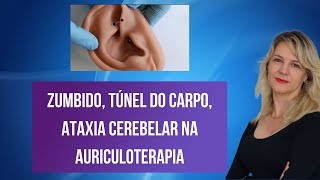 Zumbido túnel do carpo ataxia cerebelar na Auriculoterapia [upl. by Pet]