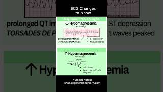 ECG Changes to Know in Electrolyte Imbalances  EKG Interpretation Nursing shorts [upl. by Wiskind914]