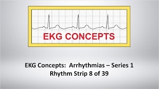 EKG Concepts Arrhythmias Course  Strip 8 of 39 [upl. by Lennad412]