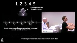 How to Perform Valsalva Maneuver in Patients with HCM [upl. by Loris]