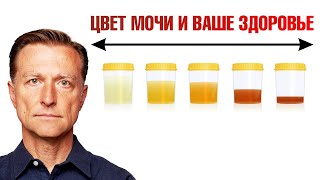 О чем говорит цвет мочи Цвет мочи как индикатор здоровья🙌 [upl. by Schatz490]