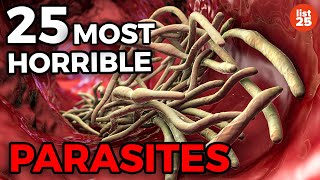 25 Parasites You Do Not Want To Be Infected With [upl. by Aeneus]