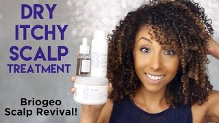 Dry Itchy Scalp Treatment Briogeo Scalp Revival Review  BiancaReneeToday [upl. by Gaddi]