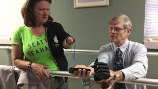 First Bionic Hand Moments from Cornerstone Patient [upl. by Lertnom]