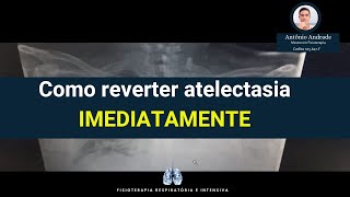 Como Reverter Atelectasia Imediatamente [upl. by Ardel394]