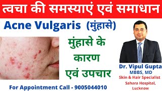 Acne Vulgaris मुंहासे  मुंहासे के कारण और उपचार  Skin Problems amp Solution  By Dr Vipul Gupta [upl. by Leverett]