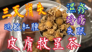 《皮膚救星茶》💯過敏紅腫、暗瘡、濕疹、失眠 😨 每日一杯🥃三天全消失🥰《Skin Savior Tea》 Allergic redness acne and eczema disappear [upl. by Ula]