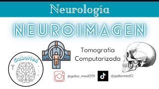 Neuroimagen  Tomografía Computarizada [upl. by Lani]