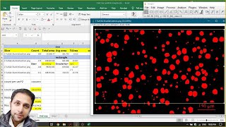 Particle count and Area Fracture study for Spheroidal Graphite Ductile Cast Iron [upl. by Magda106]