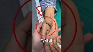 Segera lari jika jarimu tumbuh lagi‼️😱 [upl. by Koal]